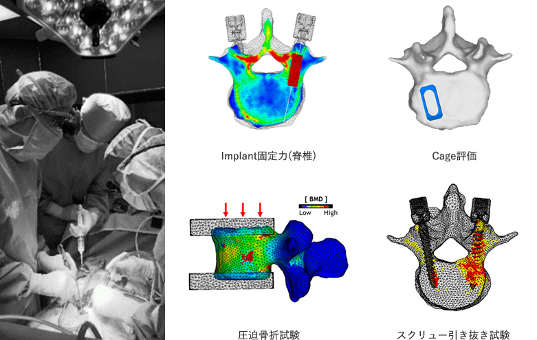 Implant固定力(脊椎)、Cage評価、圧迫骨折試験、スクリュー引き抜き試験の画像