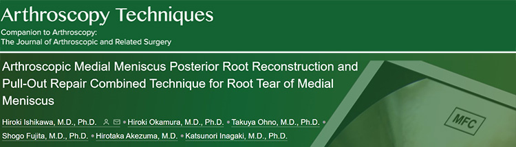 兼任講師である石川 大樹（いしかわ ひろき）先生（日本鋼管病院）の論文がArthroscopy Techniquesに掲載されました